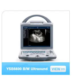 YSENT-JE1A портативный Перезаряжаемый отоскоп с хорошей ценой