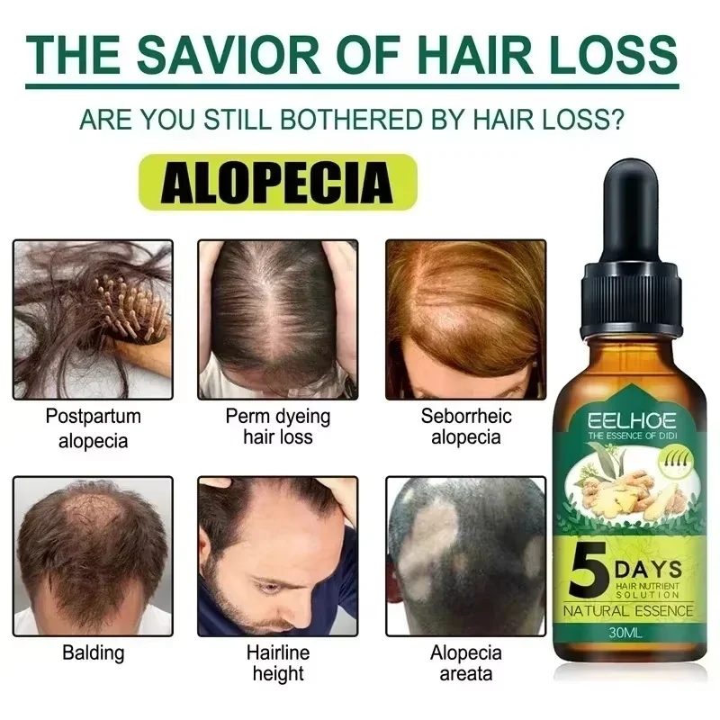 Сыворотка против Alopecia эфирное масло имбирный спрей для роста волос выпадения