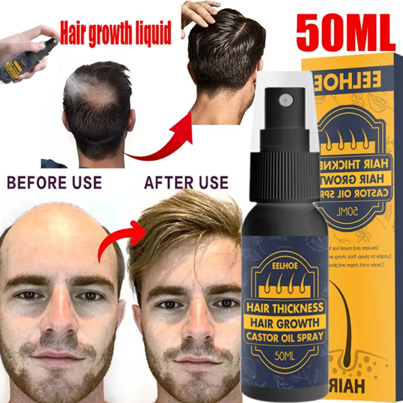 

50ml Hair Growth Spray Serum Castor Oil Anti Hair Loss Fast Grow Scalp Repair Hair Regrowth Thinning Treatment for Women & Men
