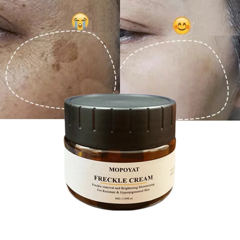 

Effective Whitening Freckle Cream Anti-aging Remove Melasma Dark Spot Lightening Melanin Brighten Melasma Moisturize Face Care