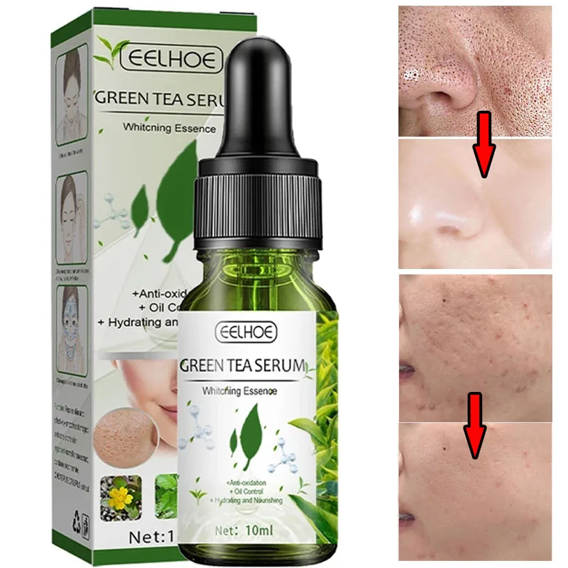 

Green Tea Pore Shrink Face Serum Remove Dark Spots Improve Acne Blackheads Dry Skin Oil Control White Cream Skin Care Products