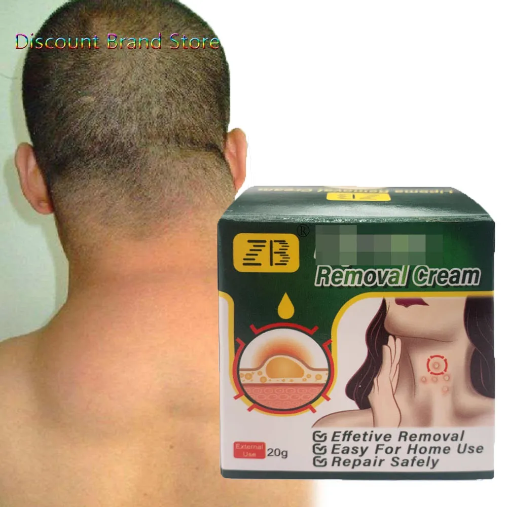 

20g Lipoma Removal Cream Fatty Tumor Ointment Specialized Chinese Medicine Eliminate Hard Lumps Multiple Genuine Products