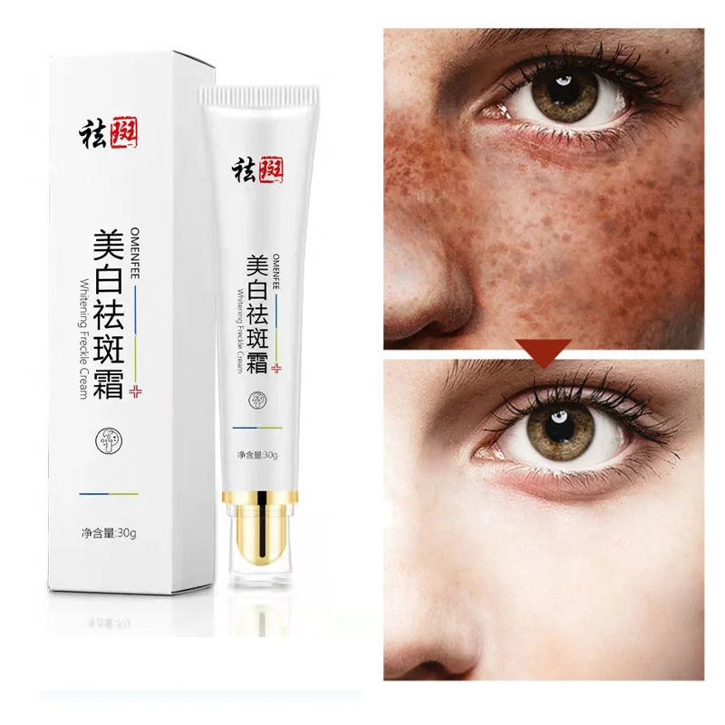 

Effective Whitening Freckle Cream Remove Melasma Acne Spot Pigment Melanin Dark Pigmentation Moisturizing Gel Skin Care