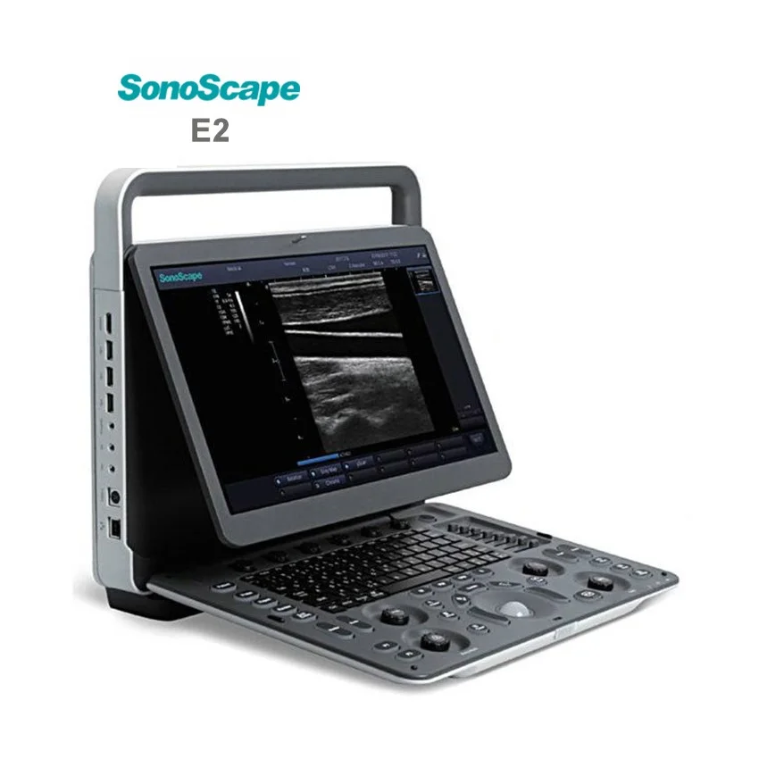 SonoScape E2 Ultrasound Machine Portable Color Doppler Ultrasound System
