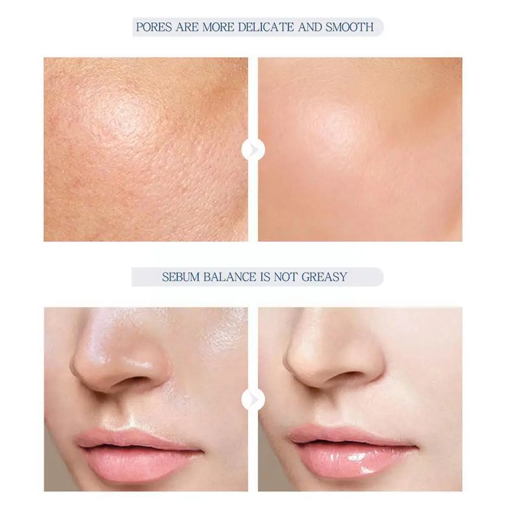 Эфирное масло витамина Е 100% Натуральные эффективные растяжки 42900 уменьшение