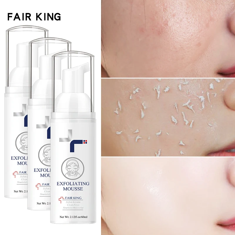 3PCS FAIRKING Effective Face Cleanser Deep Removing Dead Skin Pore Exfoliating Mousse For Facial Care Moisturizing Oil Control