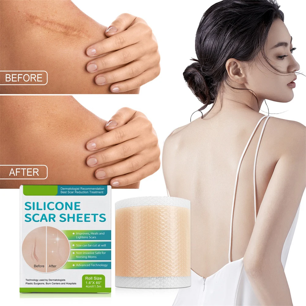 

4x150cm Silicone Scar Sheets Painless Scar Repair Tape Roll Effective Scar Removal Strips for C-Section Keloid Surgery Burn Acne