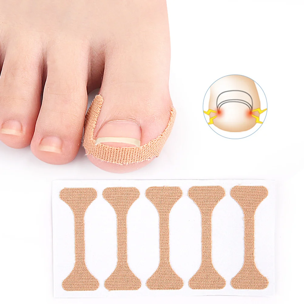 

100 Pcs Tools Nail Corrector Patch Toenail Manicure Ingrown Correction Sticker Patches Elastic Fabric Stickers