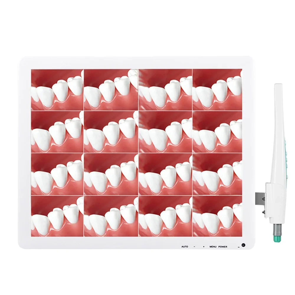 Стоматологическая внутриоральная камера с 17-дюймовым ЖК-монитором и Wi-Fi