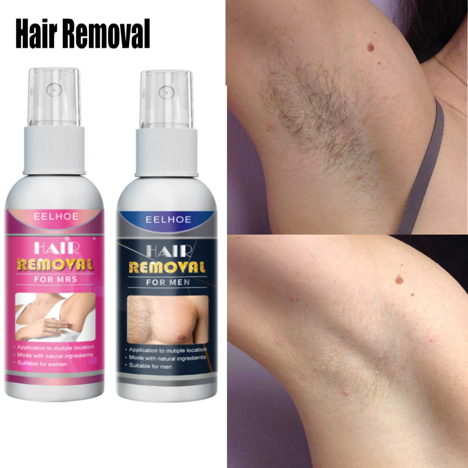 

Спрей для перманентного удаления волос, безболезненное средство для удаления волос на руке, ингибитор роста волос, товары для ухода за тело...