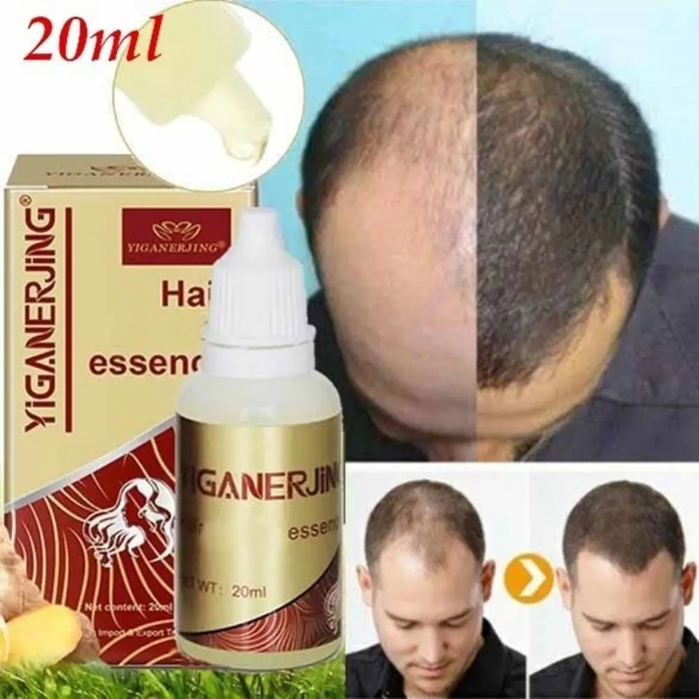 

Unisex Hair Growth Essence Anti Loss Scalp Treatment Oil Control Health Care