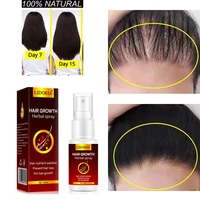 ginger hair growth spray serum anti hair loss products effective fast growing essence repair damaged thinning dry scalp care