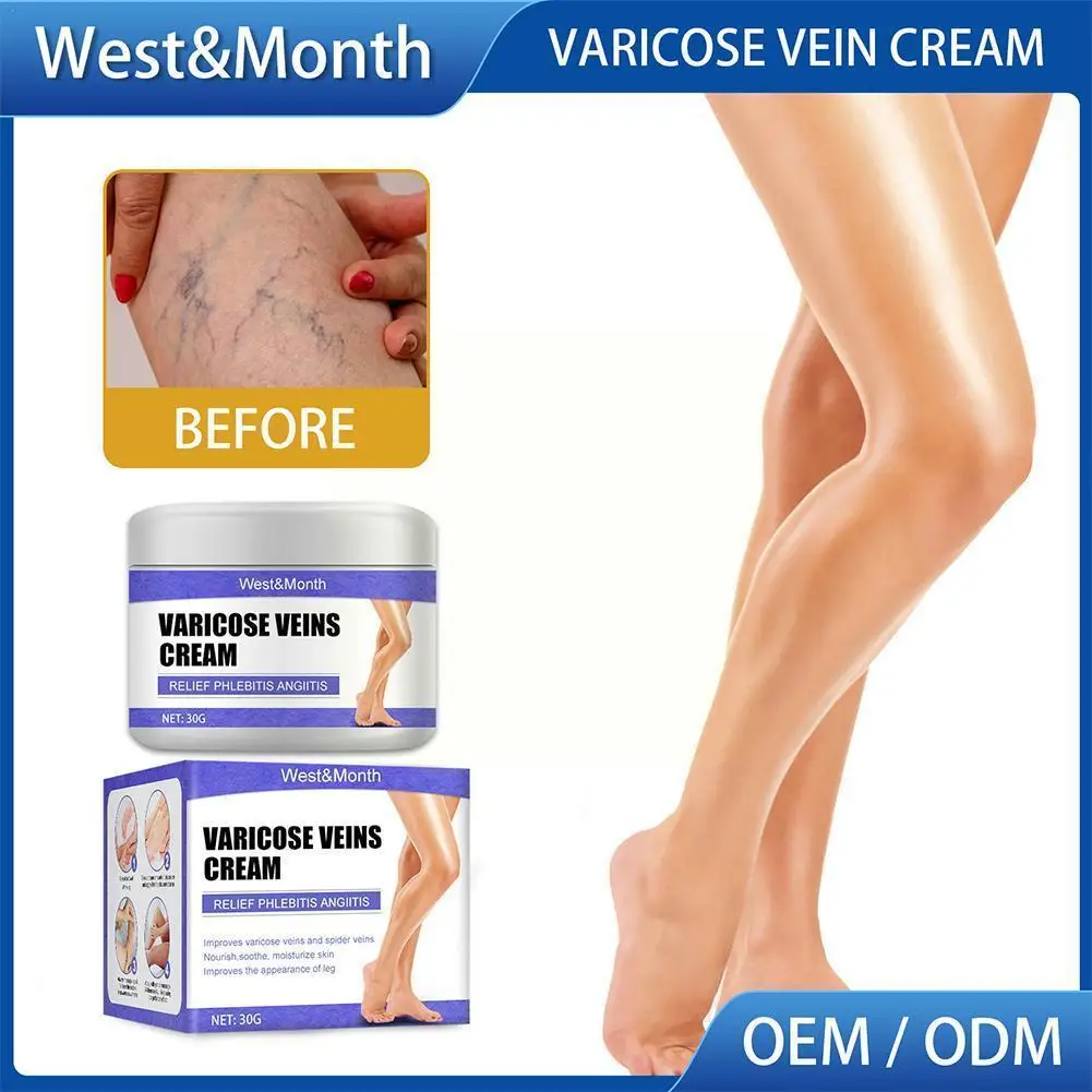 

30g Varicose Veins Relief Cream Effective Relieve Vasculitis Pain Veins Care Body Earthworm Spider Medical Leg Ointment Bul R9G6