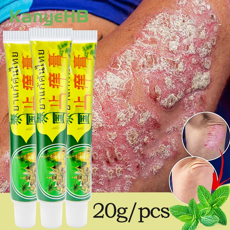 

3Pcs Tinea Pedis Psoriasis Ointment Inhibit Fungi Eczema Rash Herbal Medical Cream Relief Itch Swell Athlete's Foot Cream A1215