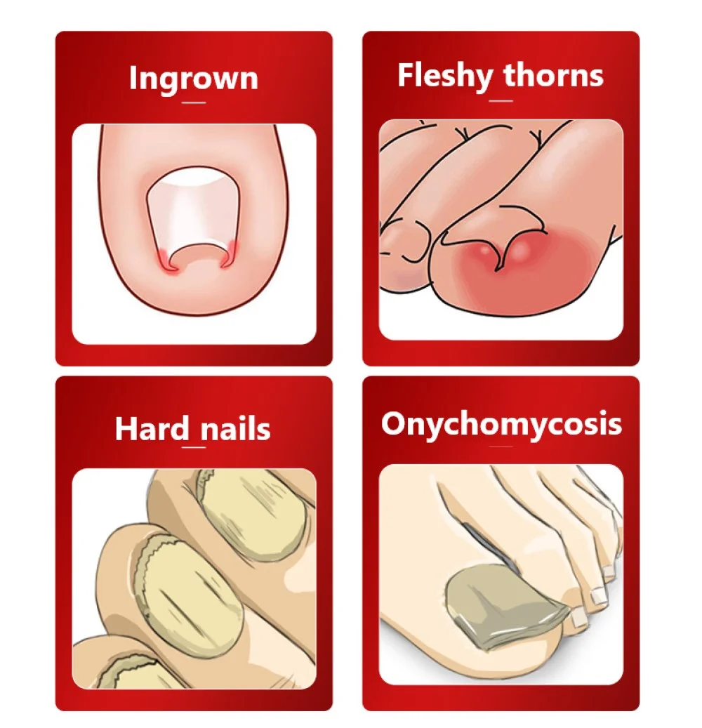 1 шт. профессиональные ножницы для удаления кутикулы на ногтях