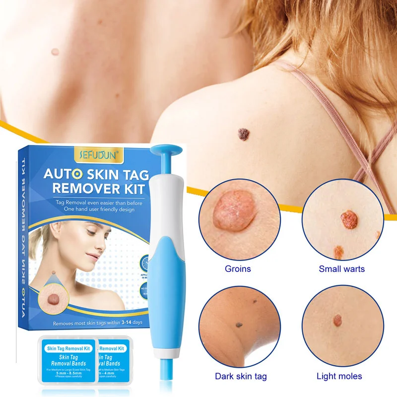 

Removal Warts Tool Removing Against Skin Tag Tattoo Moles Pimple Patch Remove Black Dot Emulsion Beauty Health Cosmetic
