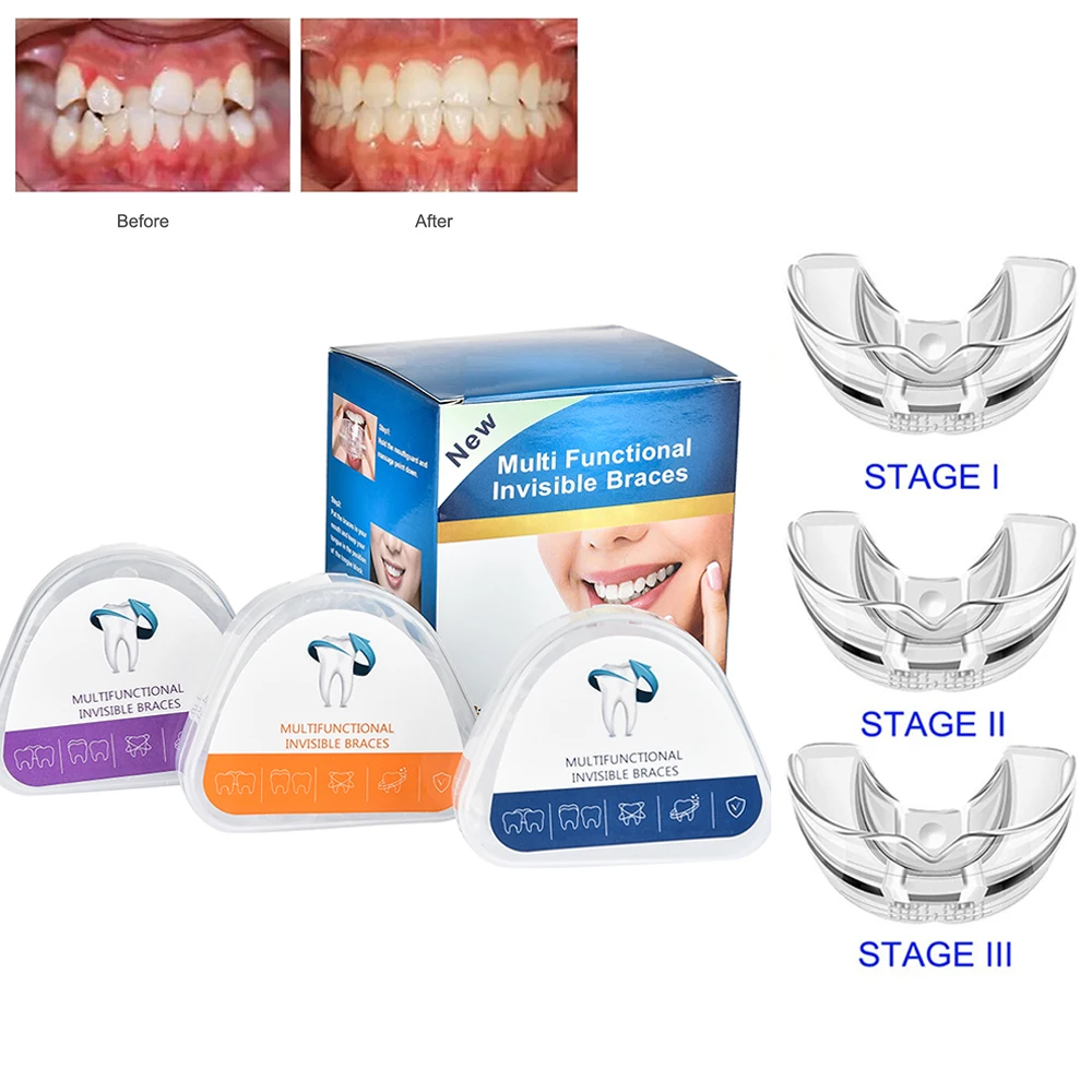 

Orthodontic Braces Dental Braces Smile Teeth Alignment Trainer Instanted Silicone Teeth Retainer Mouth Guard Braces Tooth Tray