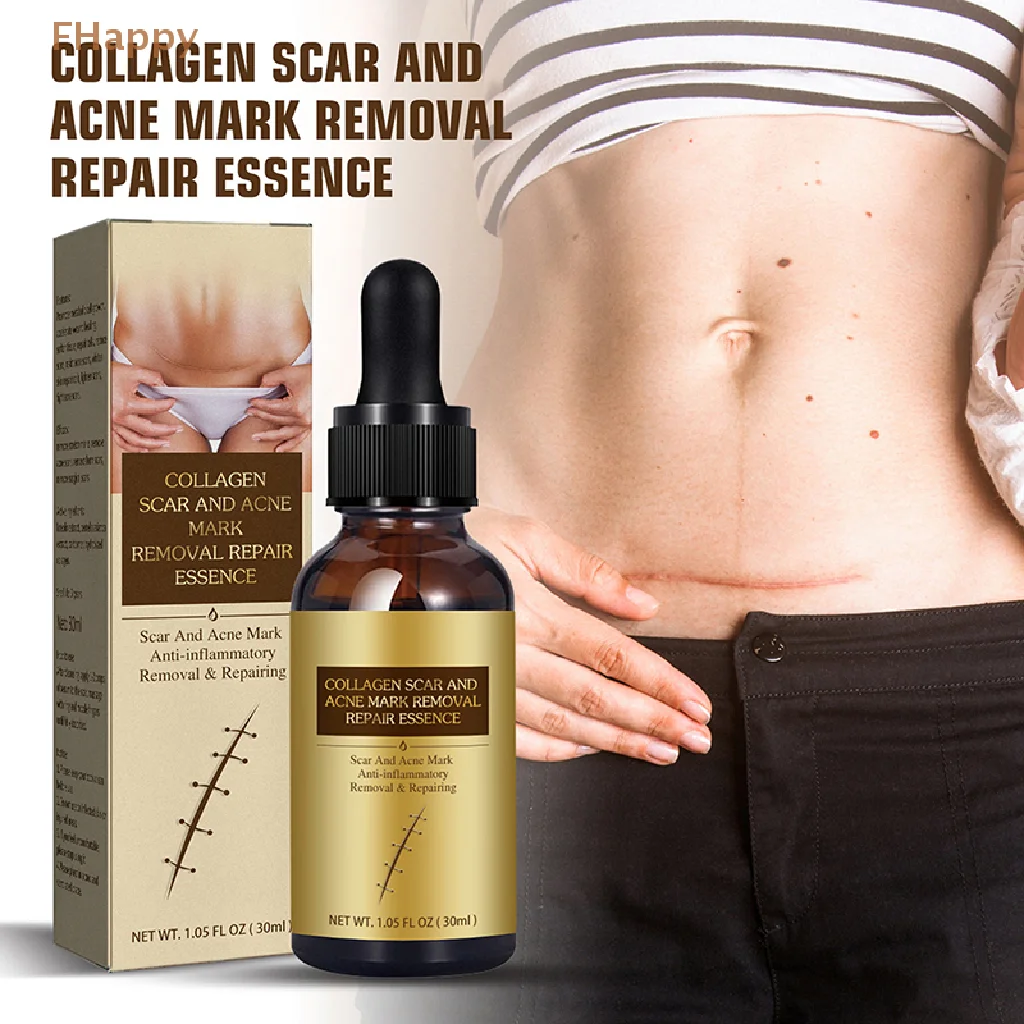 

30ml Vitamin E Oil For Scars Pure Nature Scar Essence Essential Oils For Scars And Stretchmarks Face And Body Skin Care
