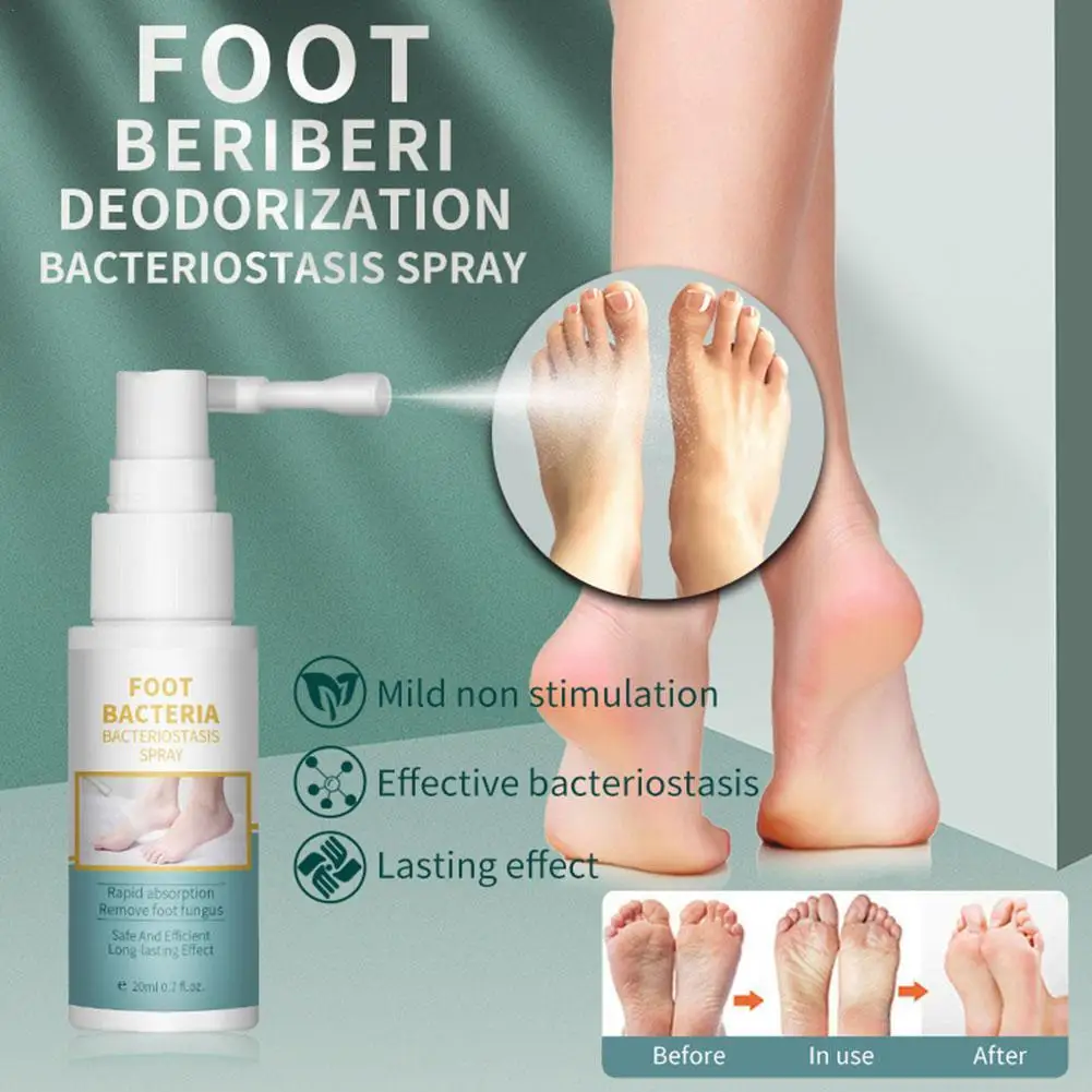 

20ml Shoe Sterilization Deodorant Spray Perfume Foot Odor Shoe Odor Nemesis Odor Removal Artifact Herbal Anti-fungal Foot Spray