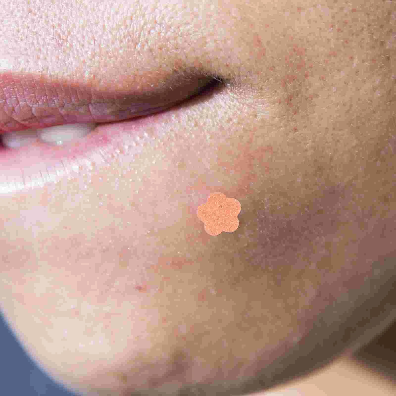 

Acne Patch Pimple Invisible Face Care Supplies Sticker Heal Patches Hydrocolloid