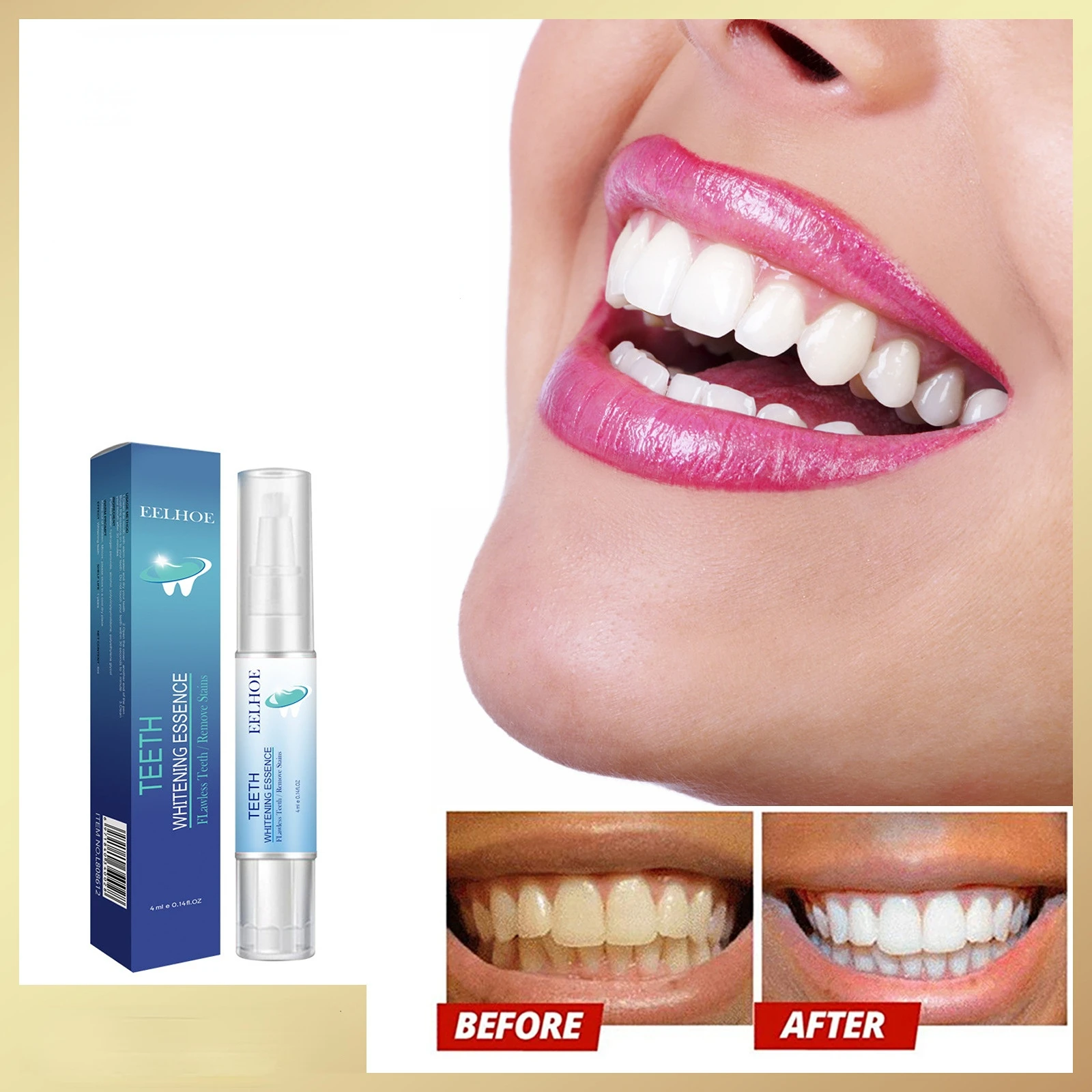 

Ручка для отбеливания зубов, гель для отбеливания зубов, бриллиантовые пятна, мгновенная улыбка, набор для отбеливания зубов, чистящая сыво...