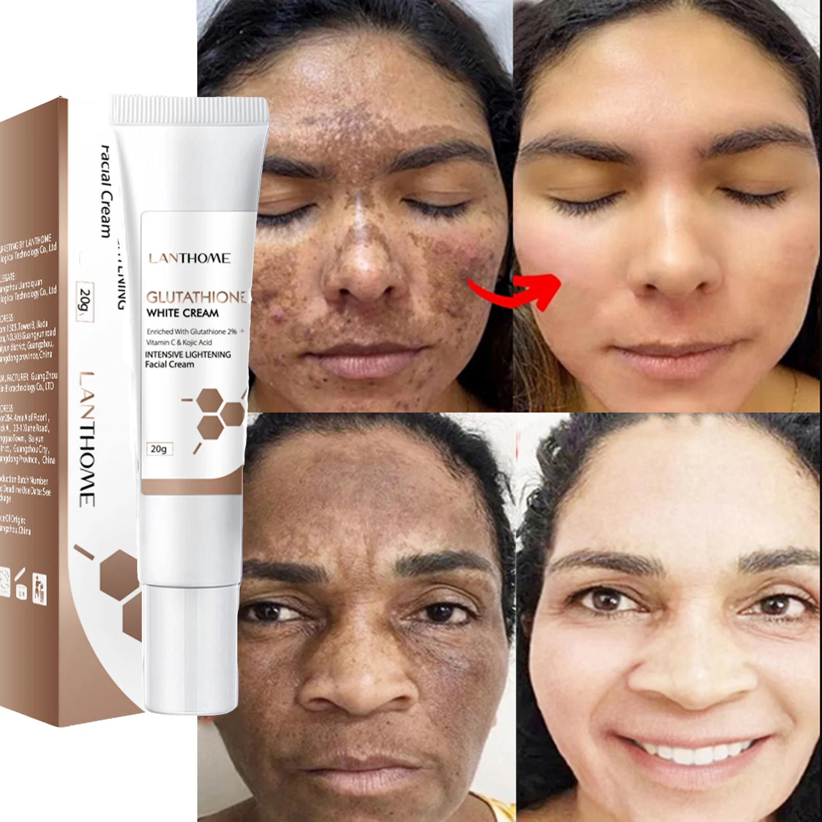 

Glutathione Whitening Freckle Face Cream Remove Dark Spots Melasma Lighten Melanin Fade Acne Scars Anti-Aging Brighten Skin Care