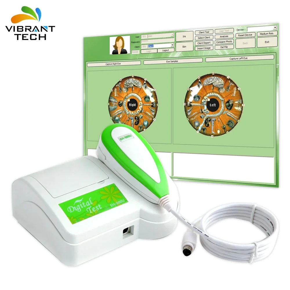 Фото Портативный медицинский прицел для глаз Iris Iriscope Iridology Camera Pro, программное обеспечение, быстрая доставка №3