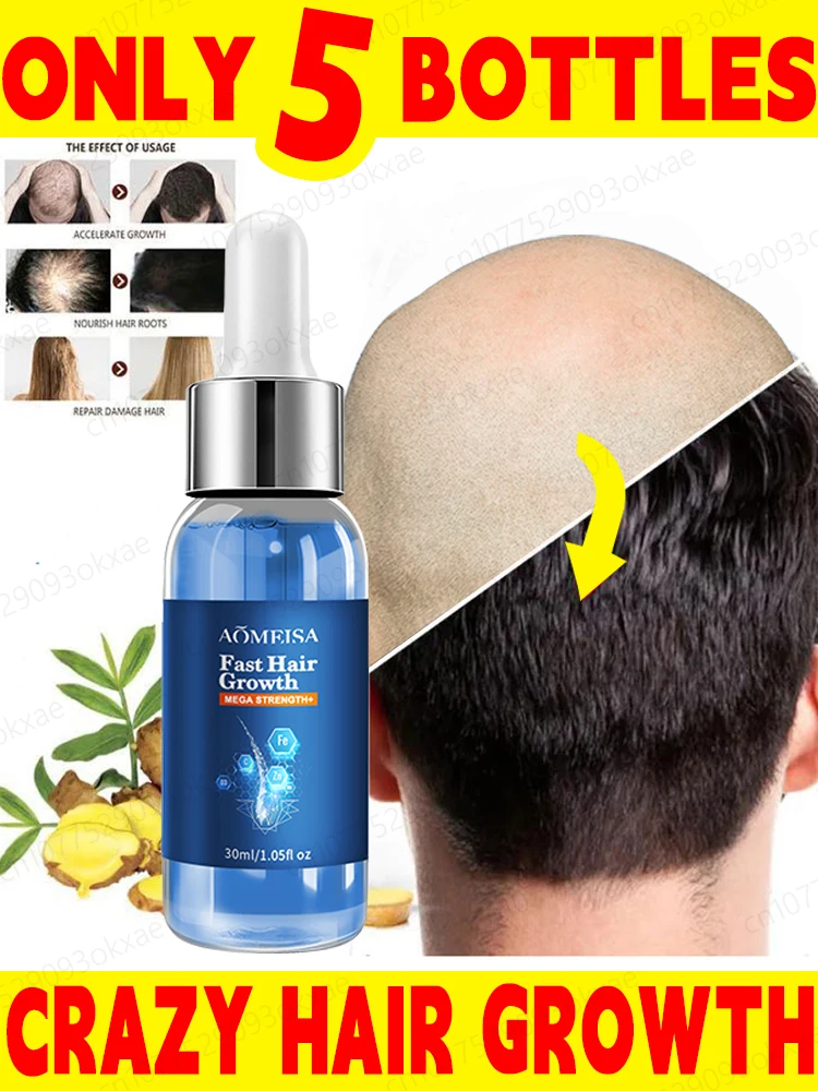 

Hair Growth Oil Fast Hair Growth Effective Baldness Repair Hereditary Hair Loss Postpartum Hair Loss Seborrheic Hair Loss Oil