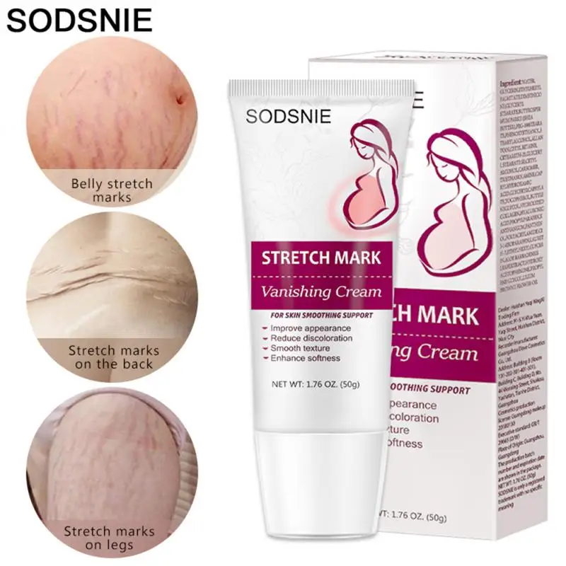 

Remove Pregnancy Scars Skin Body Cream Postpartum Stretch Marks Repair Cream Anti-Aging Fade Stretch Marks Repair Cream
