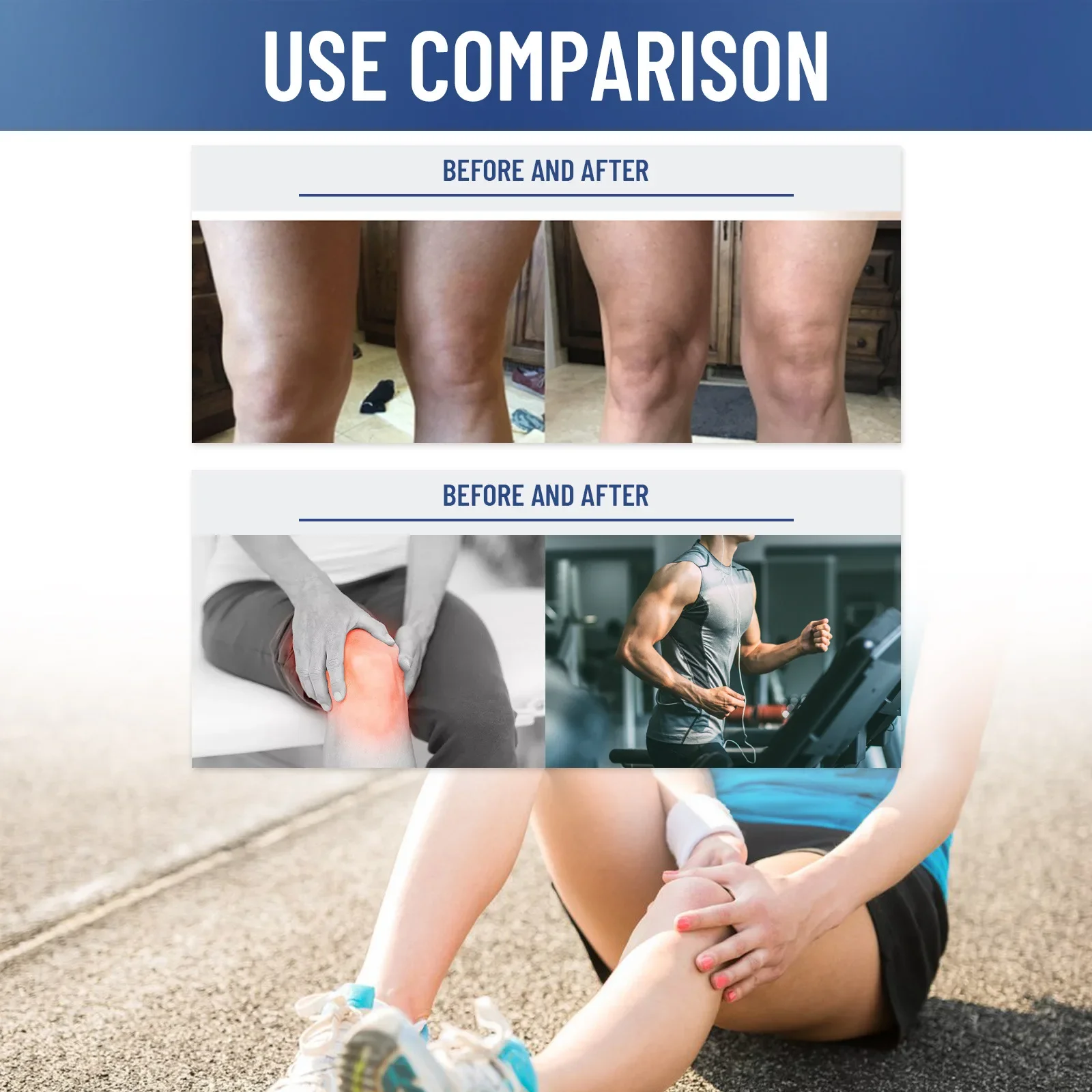 EELHOE Joint Analgesic Cream Treatment Rheumatism Arthritis Lumbar Disc Herniation Anti Inflammatory Muscle Pain Relief Ointment