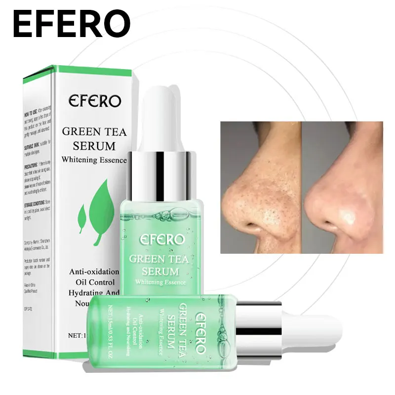 

Green Tea Oil Control Pore Shrink Face Serum Whitening Remove Dark Spots Improve Acne Blackheads Dry Skin Care Korean Cosmetics