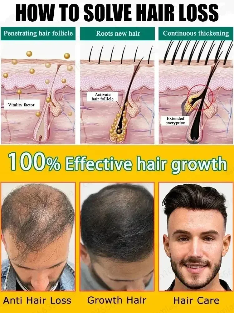 Hot selling product 99% of buyers buy again have more and hair say goodbye to baldness thick