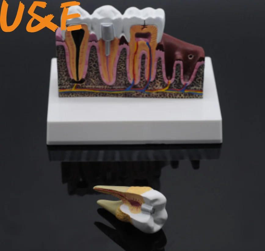 

Standard Dental Oral Teeth Anatomical Teaching Model Comprehensive Tooth Structure Model Dentist Dental Student Demonstration