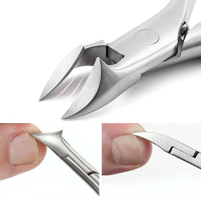 

Professional Stainless Steel Knife Pliers Pliers Pedicure To Improve Paronychia Nail Clippers Trimmer Ingrown Pedicure Care