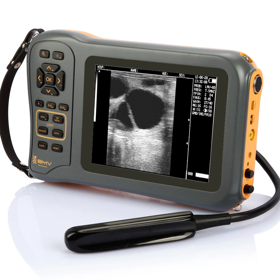 

Hot Sale Veterinary Handheld Portable B mode pregnancy Ultrasound Scanner