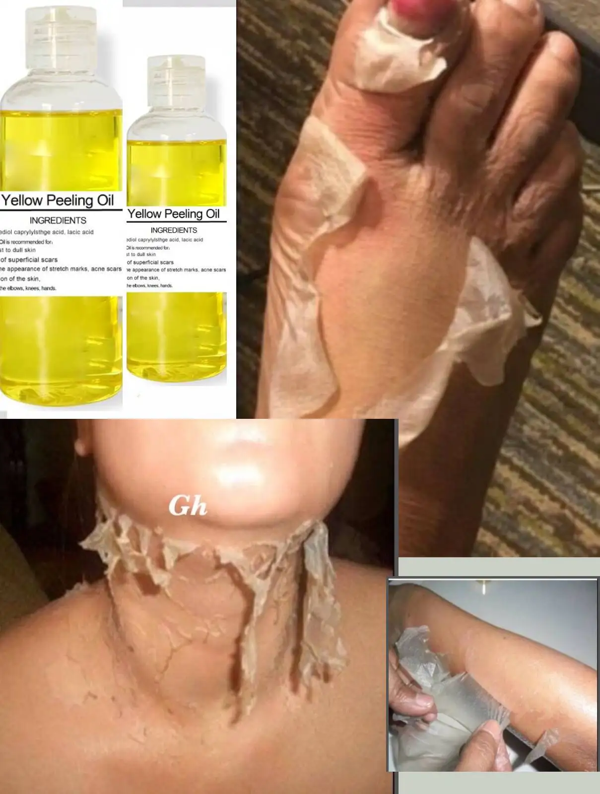 Yellow Peeling Oil Strong Yellow Peeling Oil Lighten Elbows Knees Hands Melanin Even Skin Tone and Whiten Skin