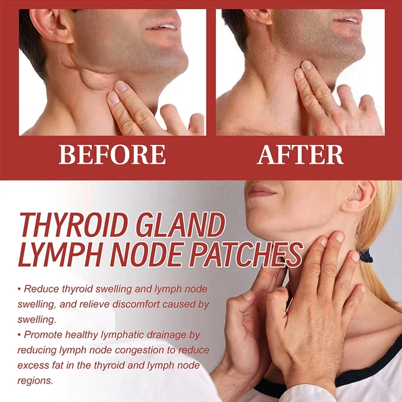 16 шт. травяные Пластыри для снятия симптомов тиреоидной железы