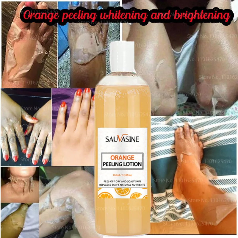 

Immediate Whitening Peeling Lotion Fnger Knee Armpit Dark Spots Body Brighten Reduce Melanin Even Skin Tone Skin Care Product