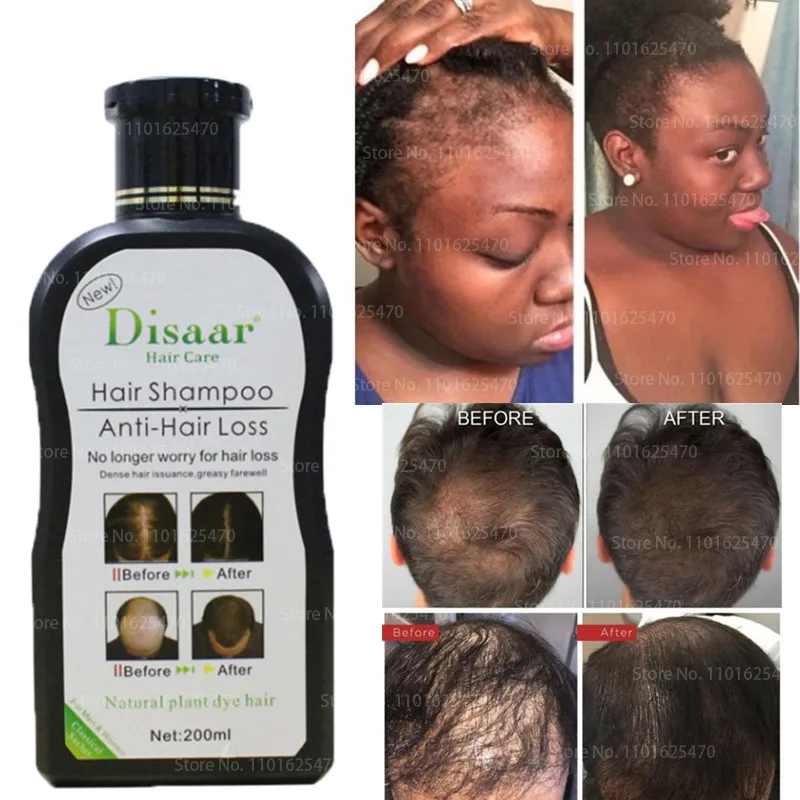

Genuine Disaar Plant Shampoo Itching Anti-dandruff Anti-hair Loss Hair Regrowth Anti-breakage Improvement Frizz Shampoo 200ml