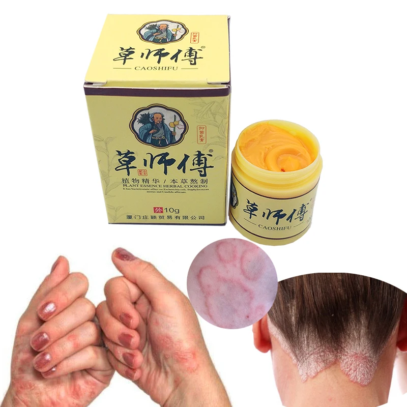 

1pc Psoriasis Eczma Cream Works Perfect For All Kinds Of Skin Problems Patch Body Massage Ointment Chinese herbal Medicine