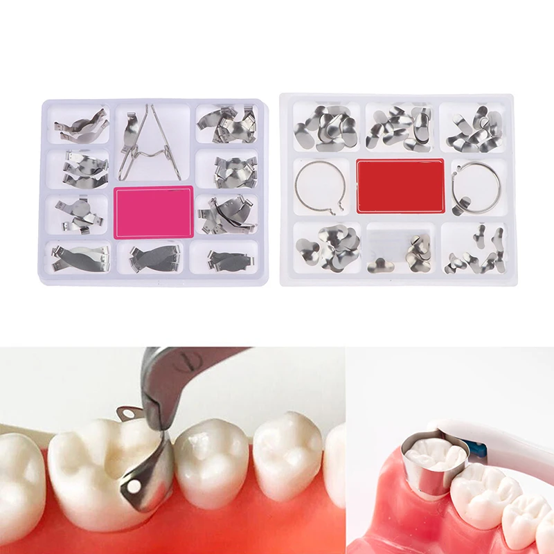 100Pcs Dental Matrix Sectional Contoured Metal Matrices Band Resin Clamping/Seperating Ring for Teeth Replacement Dental Tools