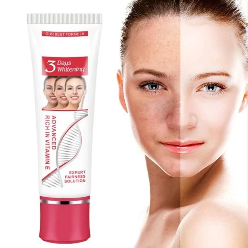 

Face Cream Moisturizing Whitening Oil Control Even Skin Tone Brighten Repair Remove Spots Niacinamide Nourish Skin Care 25/50g
