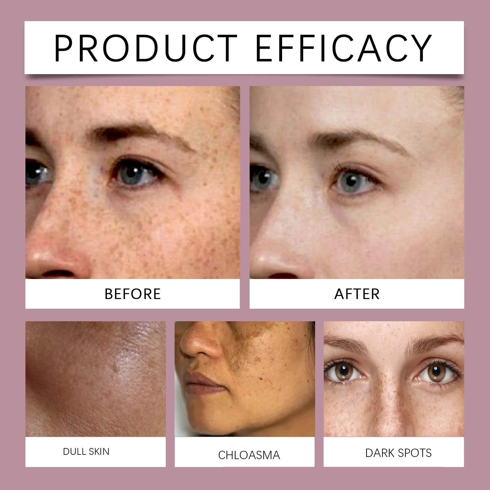 Мощный отбеливающий крем для удаления пятен осветляющий кожу быстрое устранение