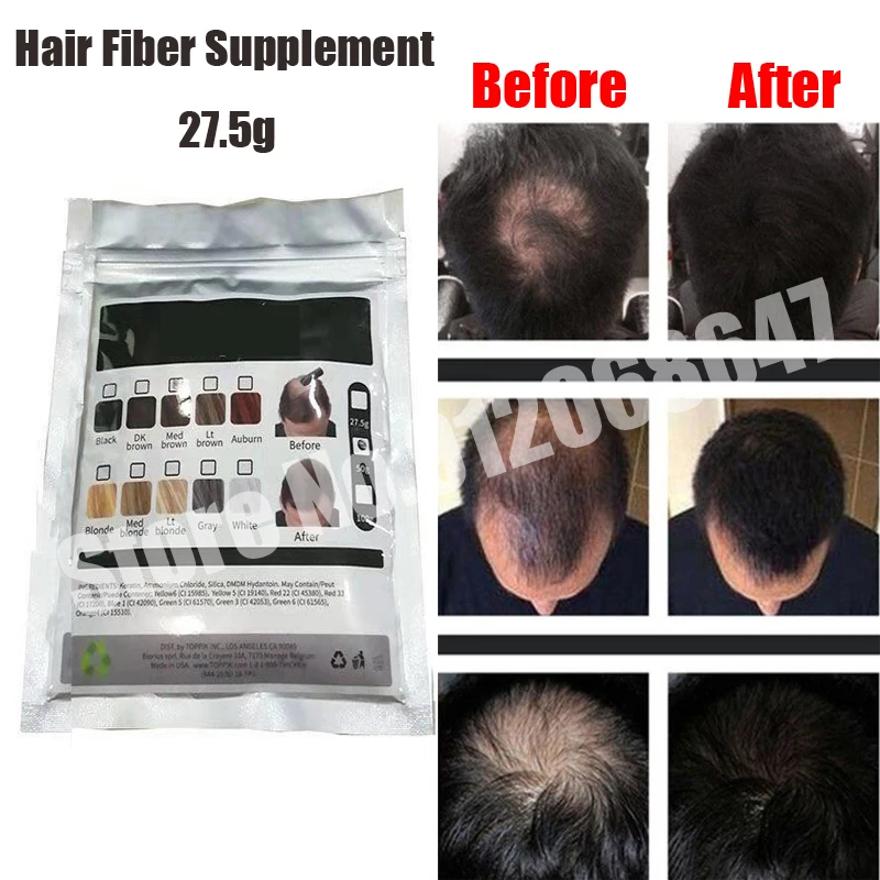

Hair Fibers Keratin Thickening Spray Hair Building Fibers 27.5g Loss Products Instant Wig Regrowth Powders Replacement Set