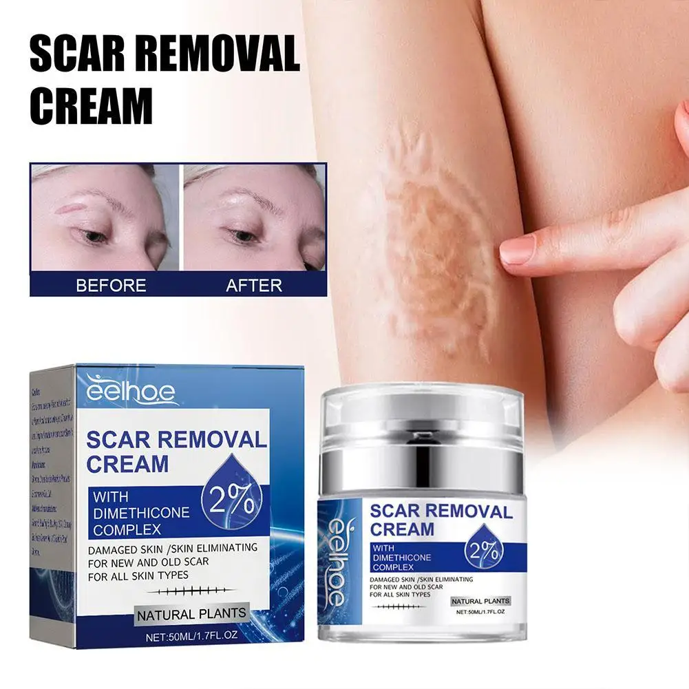 

50ml Scar Repair Cream Stretch Marks Removal Women Skin Care Acne Scars Remove Maternity Fat Striae Gravidarum Natural