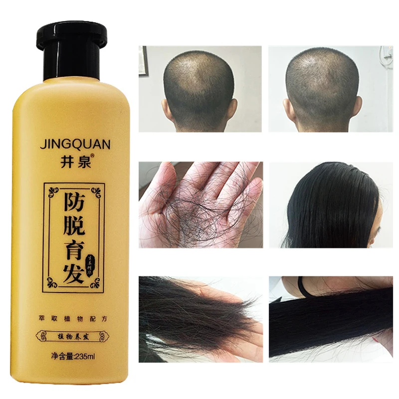 

Shampoo Prevent Hair Loss Nourish Anti-Dandruff Antipruritic Refresh Oil Control Ginger Hair Regrowth Treatment Hair Care 235ml