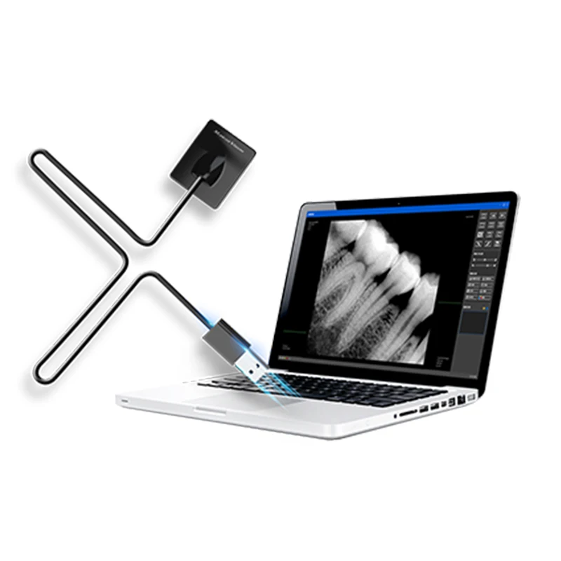 

Factory price portable dental x-ray digital rvg sensor usb