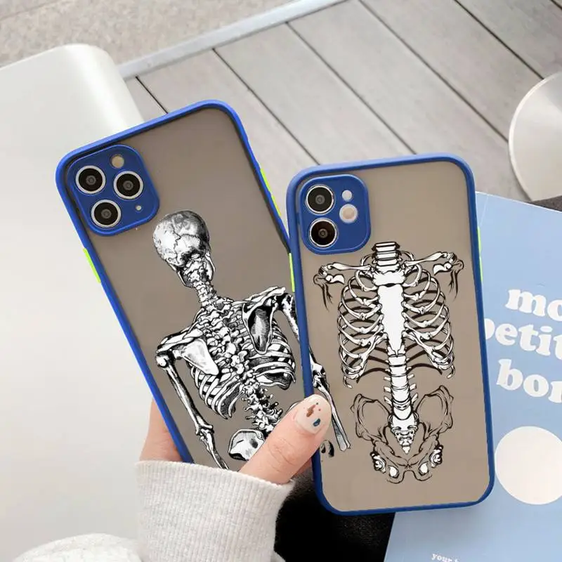 

Medical skeleton Anatomy Phone Case matte transparent For iphone 11 12 13 6 s 7 8 plus mini x xs xr pro max cover