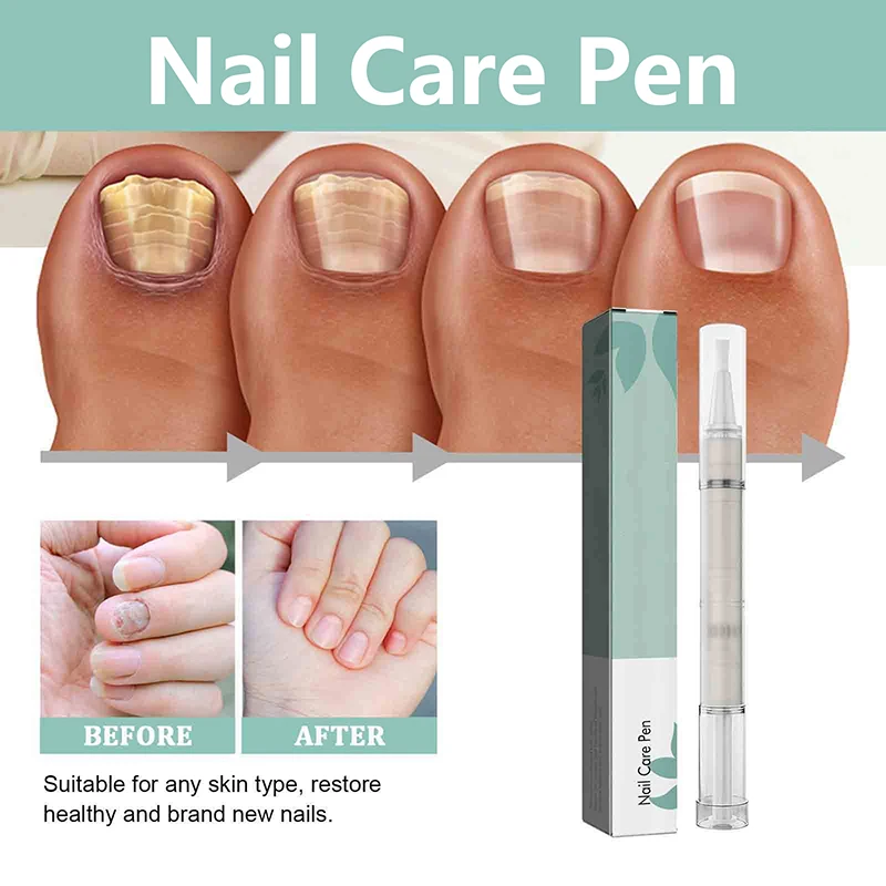 Масляная ручка для кутикулы 4 мл 1 шт.