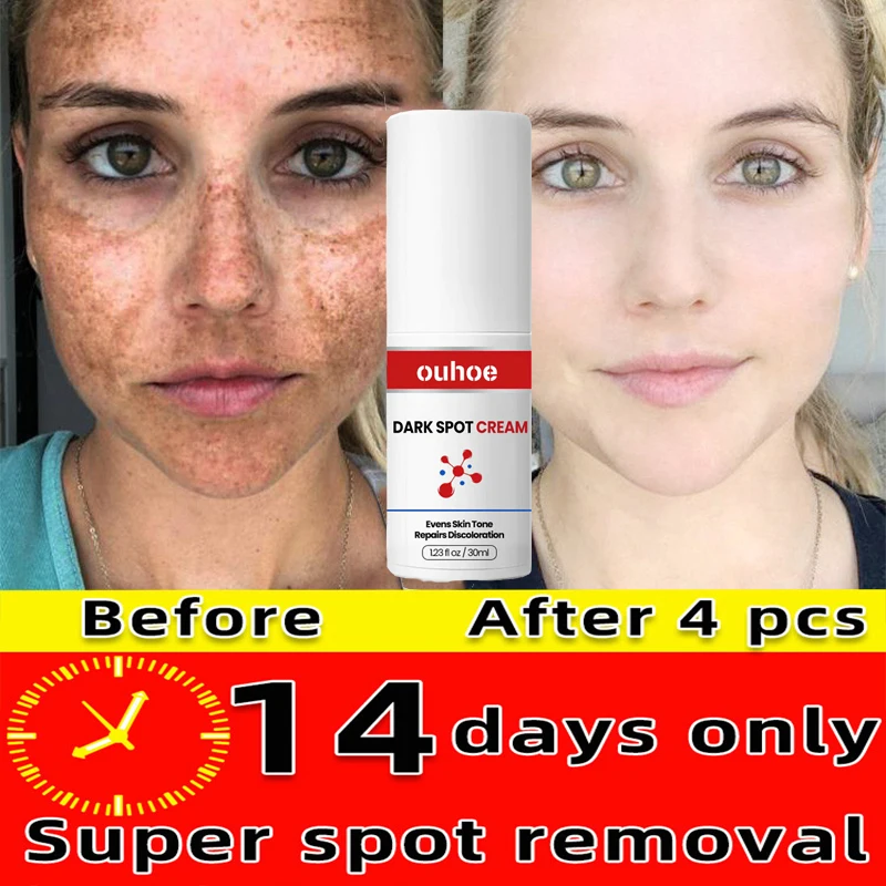 

Glutathione Whitening Freckles Cream Remove Dark Spots Melasma Lighten Melanin Fade Acne Scar Anti-Aging Brighten Face Skin Care
